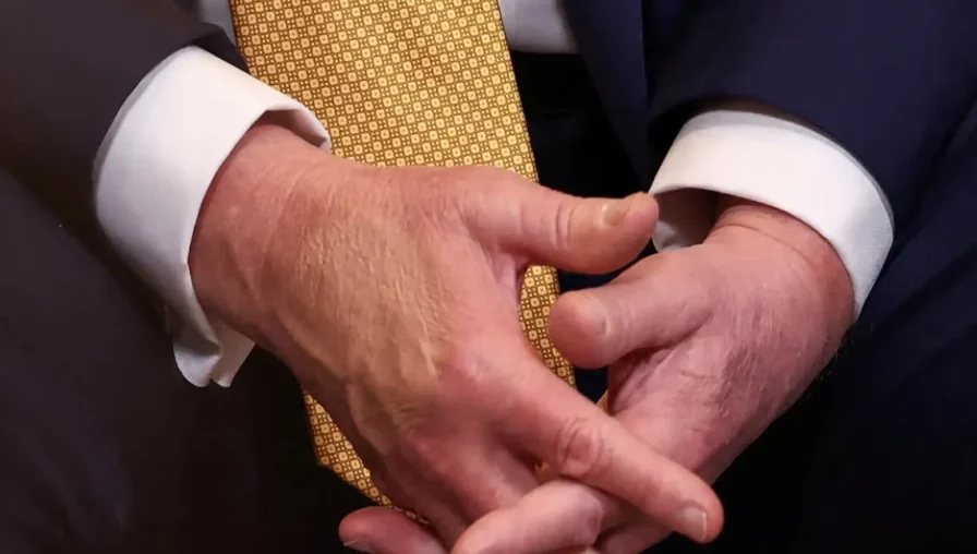 Стан здоров'я Дональда Трампа